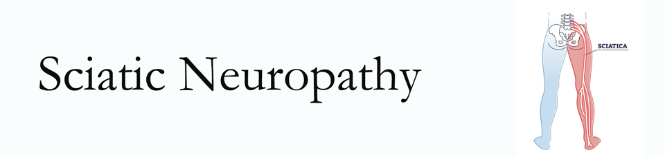 Vancouver neuropathy pain (sciatica) 